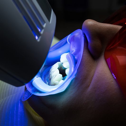 Patient receiving in office teeth whitening treatment