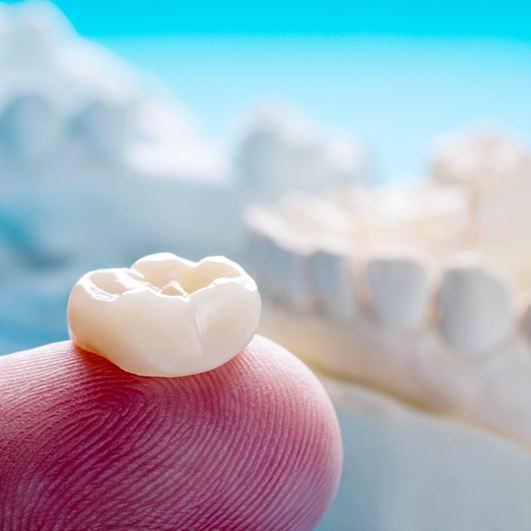 An up-close look at a dental crown sitting on the tip of a person’s finger