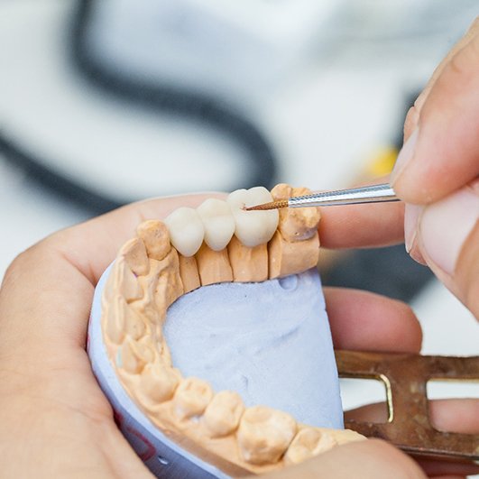 A dental lab technician creating a dental bridge for an individual