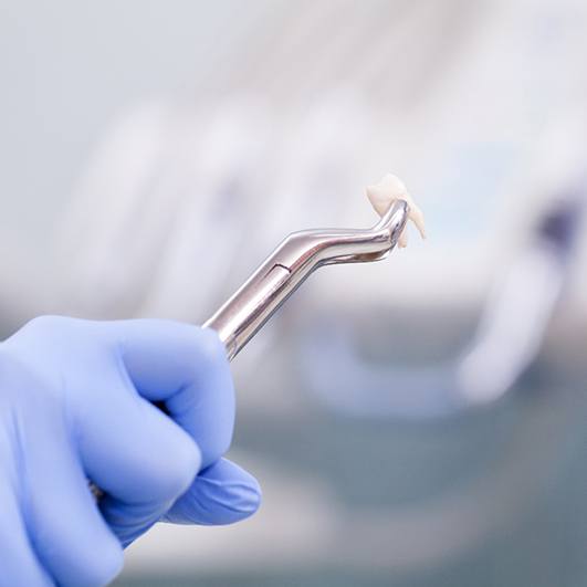 Forceps gripping extracted tooth in front of blurred background