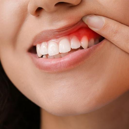 a woman experiencing pain in her gums