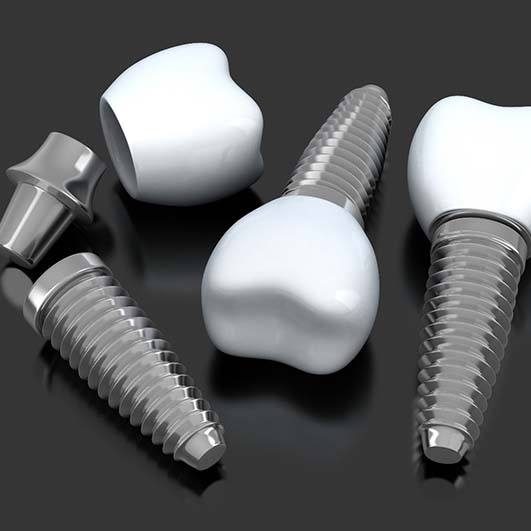 Several dental implants in Brick Township on dark background