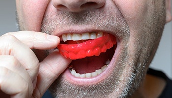 close-up of a man putting a red mouthguard into his mouth 