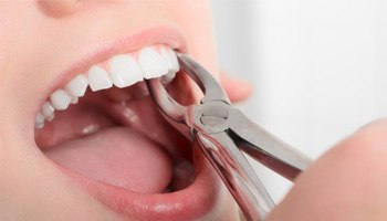 a patient undergoing a tooth extraction