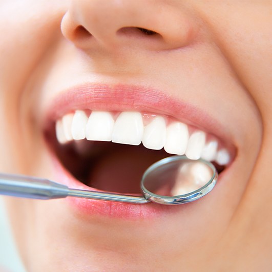 Dentist checking patient's tooth colored filling restorative dentistry solution