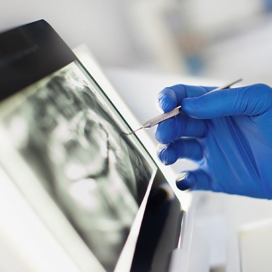 Hand pointing to digital x-rays on computer screen