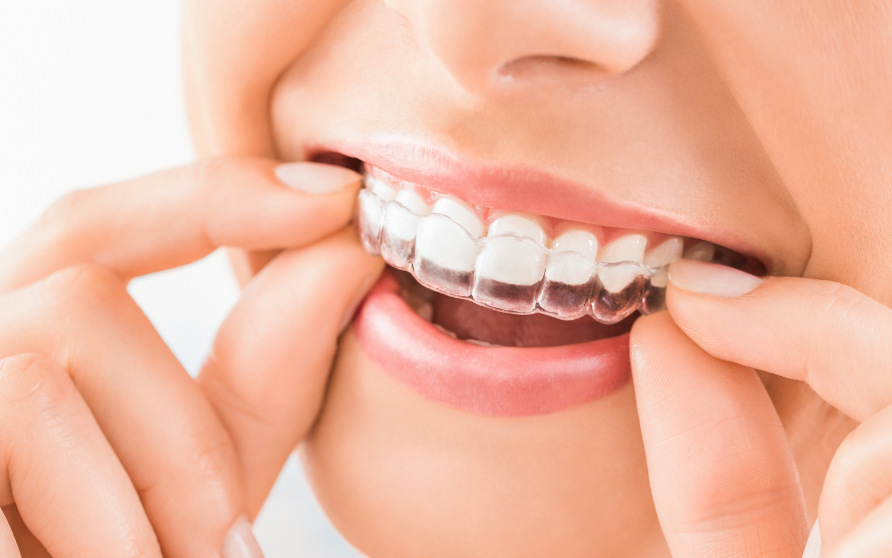 Woman wearing clear retainer