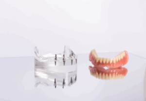 a close-up of a model of implant dentures